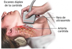 Doppler de Vasos del Cuello